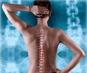 muguras mugurkaula ilustrācija