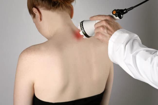 Lāzera terapiju izmanto, lai apkarotu muguras sāpes lāpstiņas zonā. 