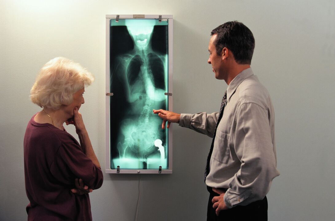 rentgena diagnostika sāpēm gūžas locītavā