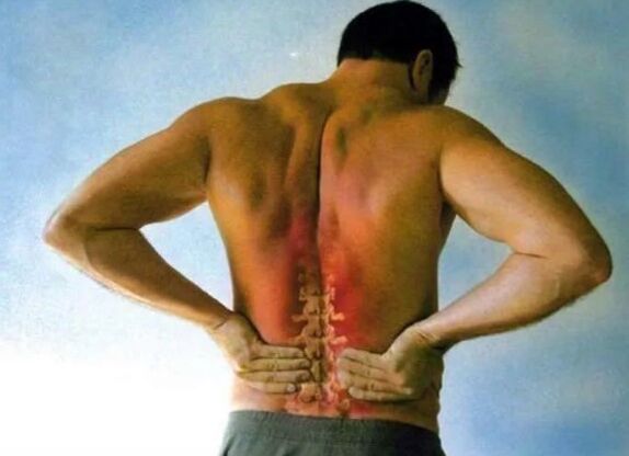 Sāpes jostas osteohondrozei